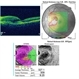 Angioid Streaks & CNV (Fig 5) Angioid Streaks & CNV (Fig 5)